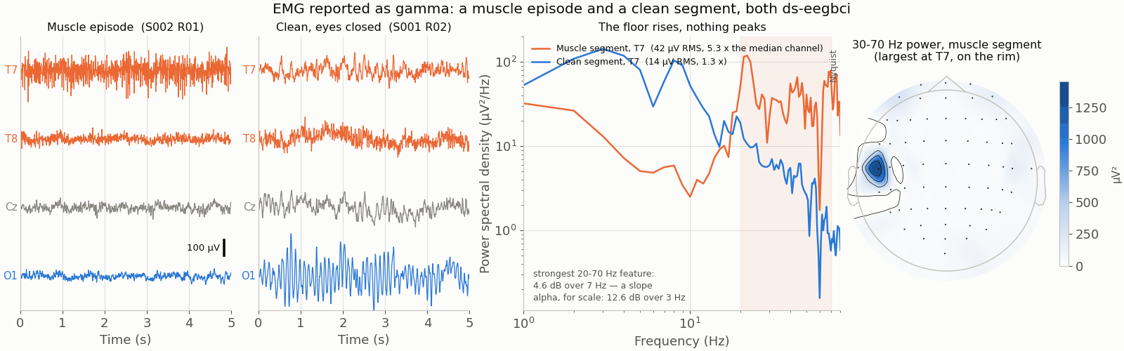 Jaw-clench EMG against clean eyes-closed EEG
